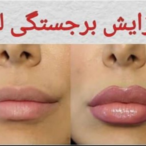 روغن خراطین اصل
