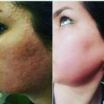 رفع مشکلات تضمینی پوست