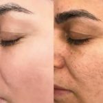 رفع مشکلات تضمینی پوست