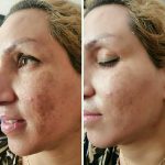 رفع مشکلات تضمینی پوست