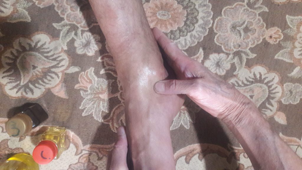 شکسته بند