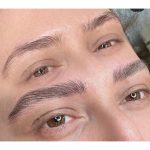 میکروبلیدینگ ومیکروپیگمنتیشن صورت