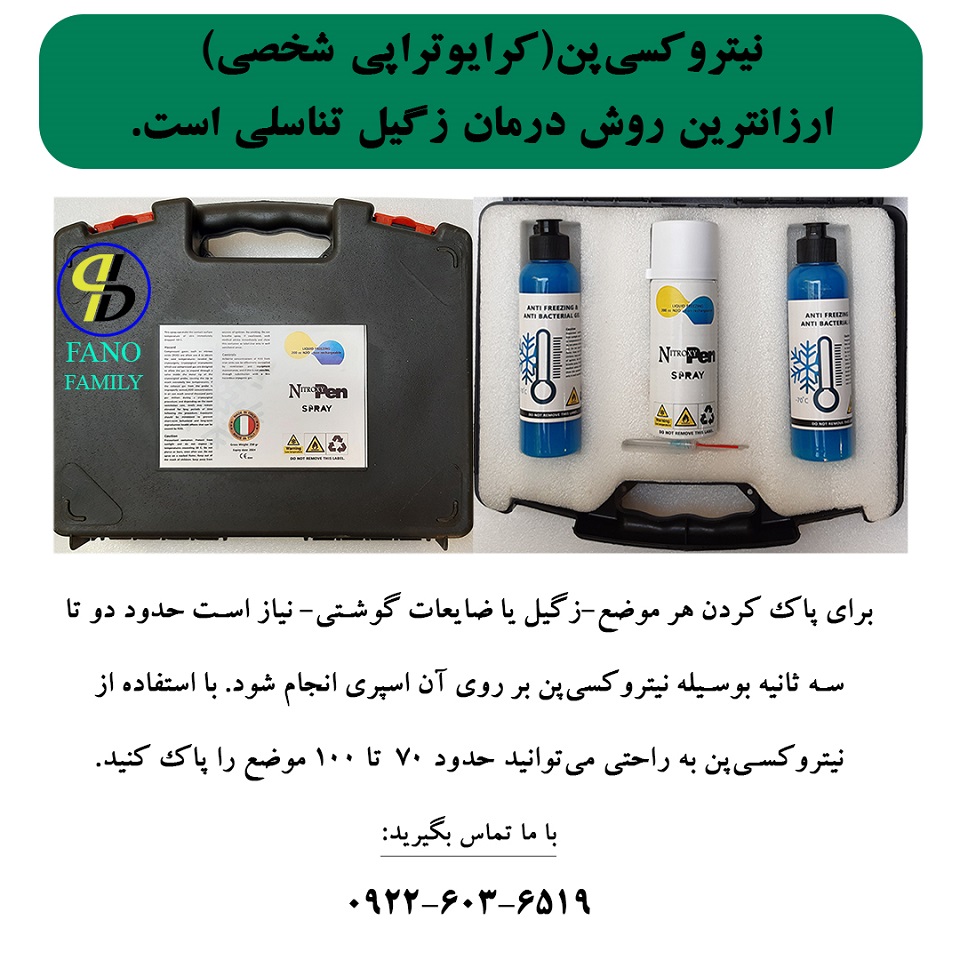نیتروکسیپن( کرایوتراپی شخصی) ارزانترین روش درمان زگیل تناسلی است.