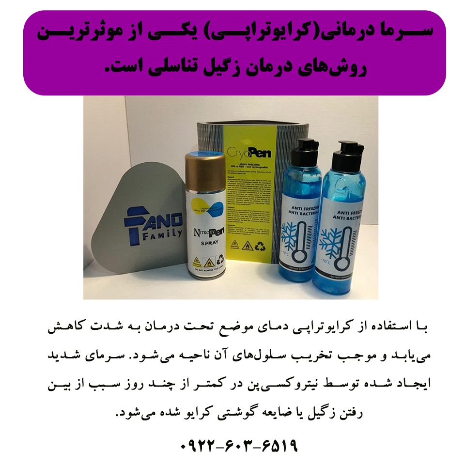 سرما درمانی کرایوتراپی