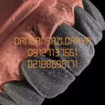لابراتوار دندانسازی سعادت آباد