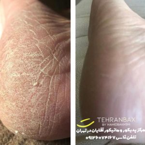 پدیکور آقایان