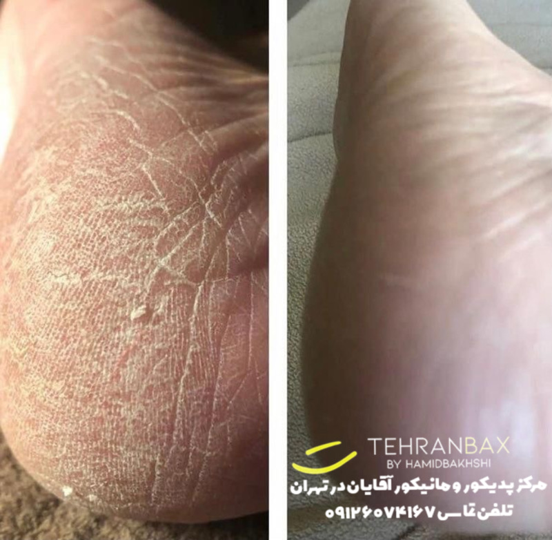 پدیکور آقایان
