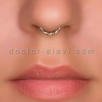 قیمت تزریق ژل گونه هفت حوض