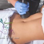 دستگاه لاغری غرب تهران