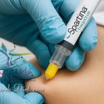 تزریق آمپول لاغری غرب تهران