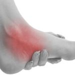 اسکن کف پا در غرب تهران